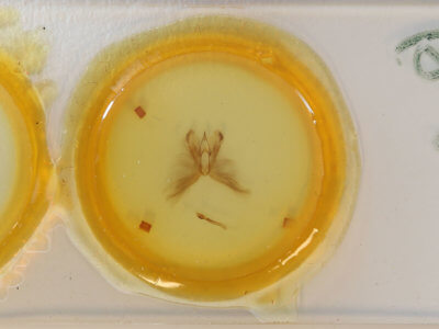 slide view of adult Anomis