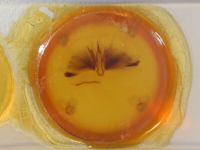 slide view of adult Oxyodes scrobiculata