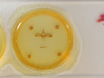 slide view of adult Carea