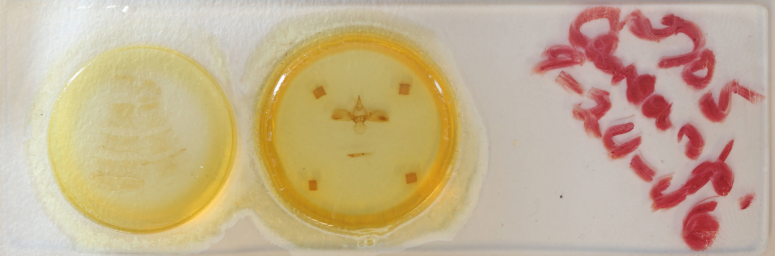 slide view of adult Carea