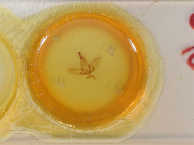 slide view of adult Colobata