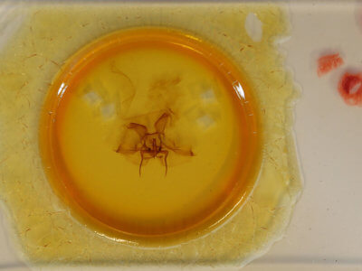 slide view of adult Epia