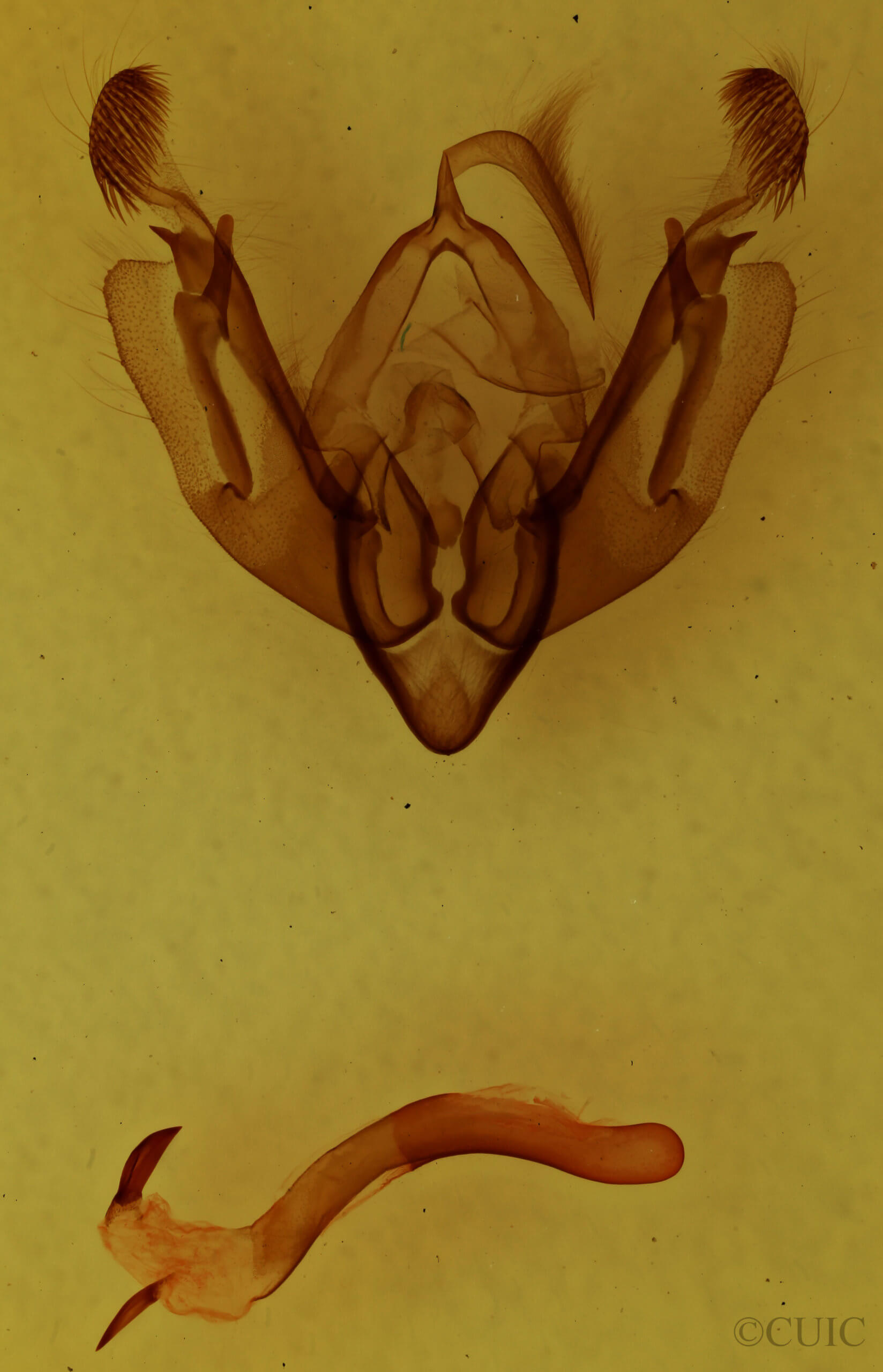 genitalia view of adult Alastria