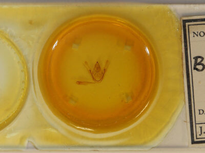 slide view of adult Amraica superans