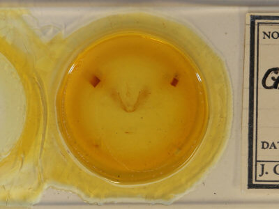 slide view of adult Timorodes blepharias