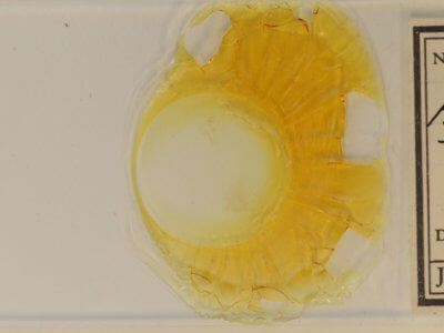 slide view of adult Hypenodes