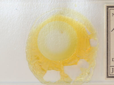 slide view of adult Hypenodes