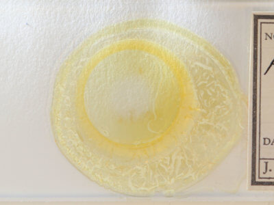 slide view of adult Hypenodes