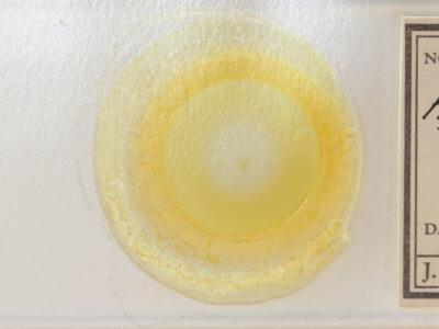 slide view of adult Hypenodes