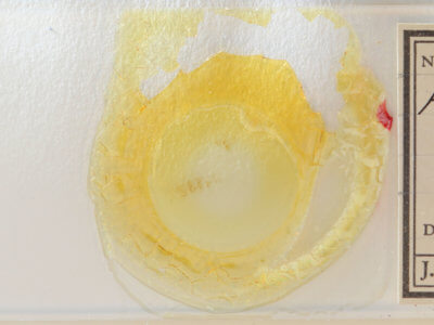 slide view of adult Hypenodes