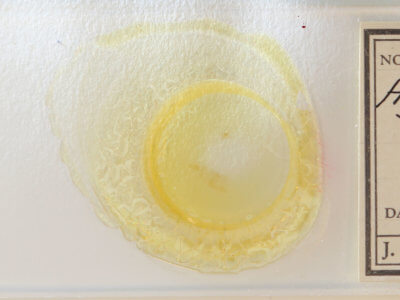 slide view of adult Hypenodes