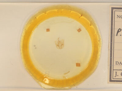 slide view of adult Perigea xanthioides