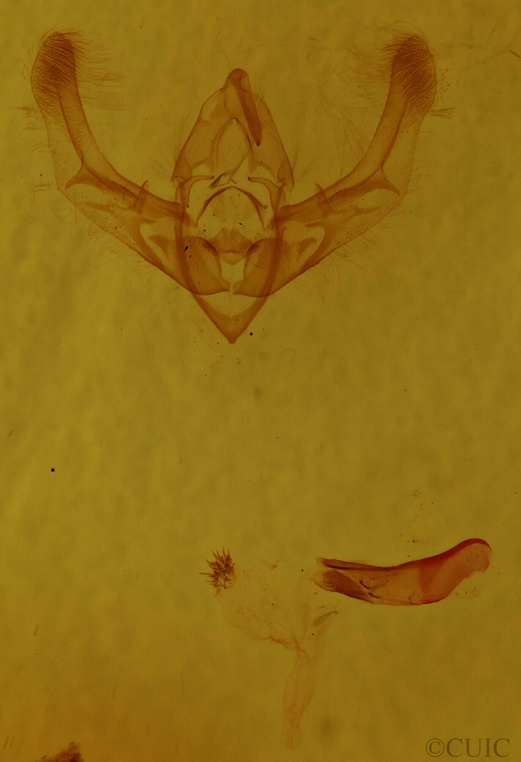 genitalia view of adult Chytonix sensilis