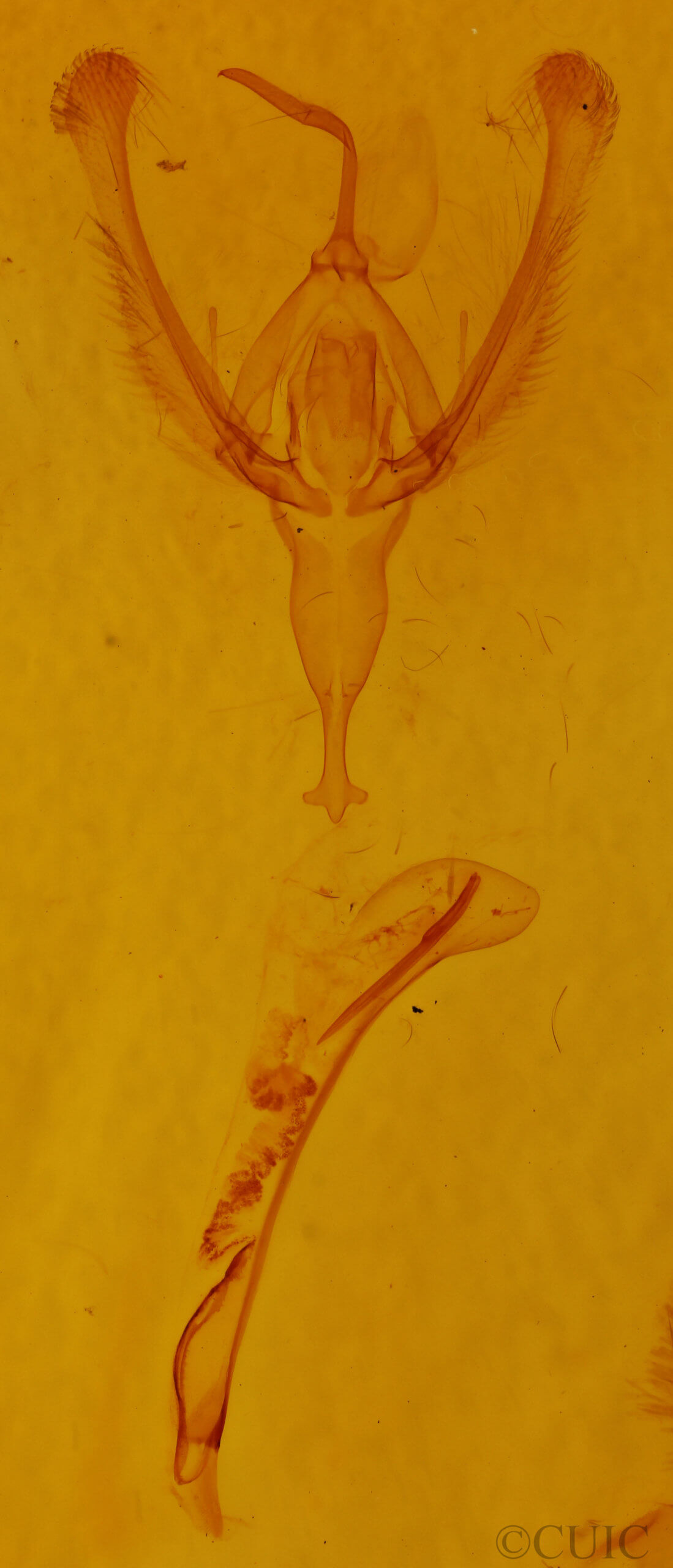 genitalia view of adult Ctenoplusia oxygramma
