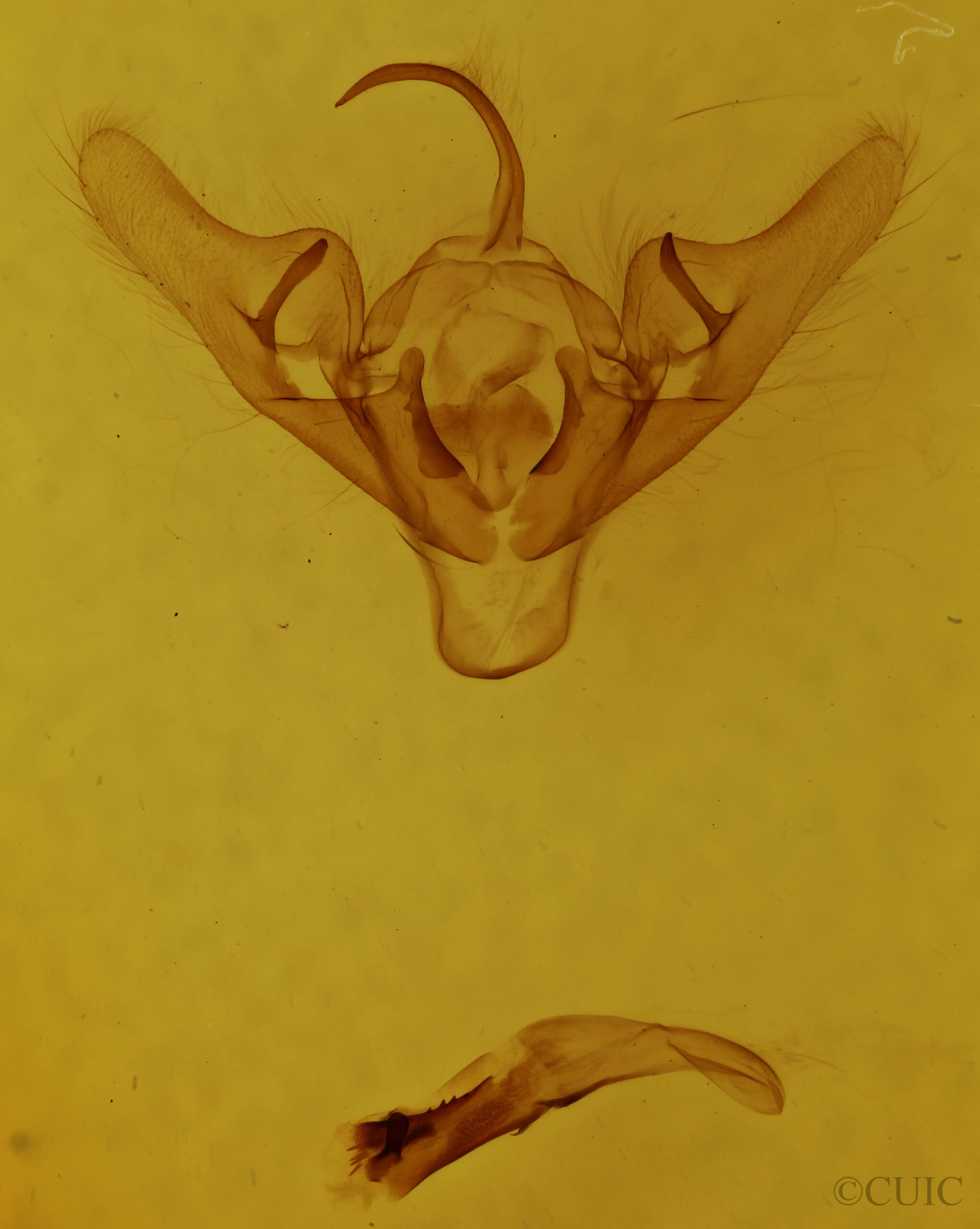 genitalia view of adult Abrostola urentis