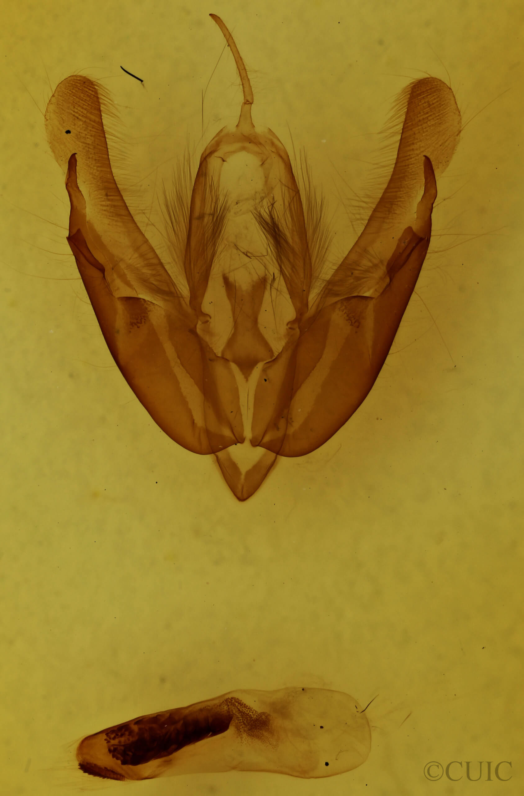 genitalia view of adult Acronicta hasta