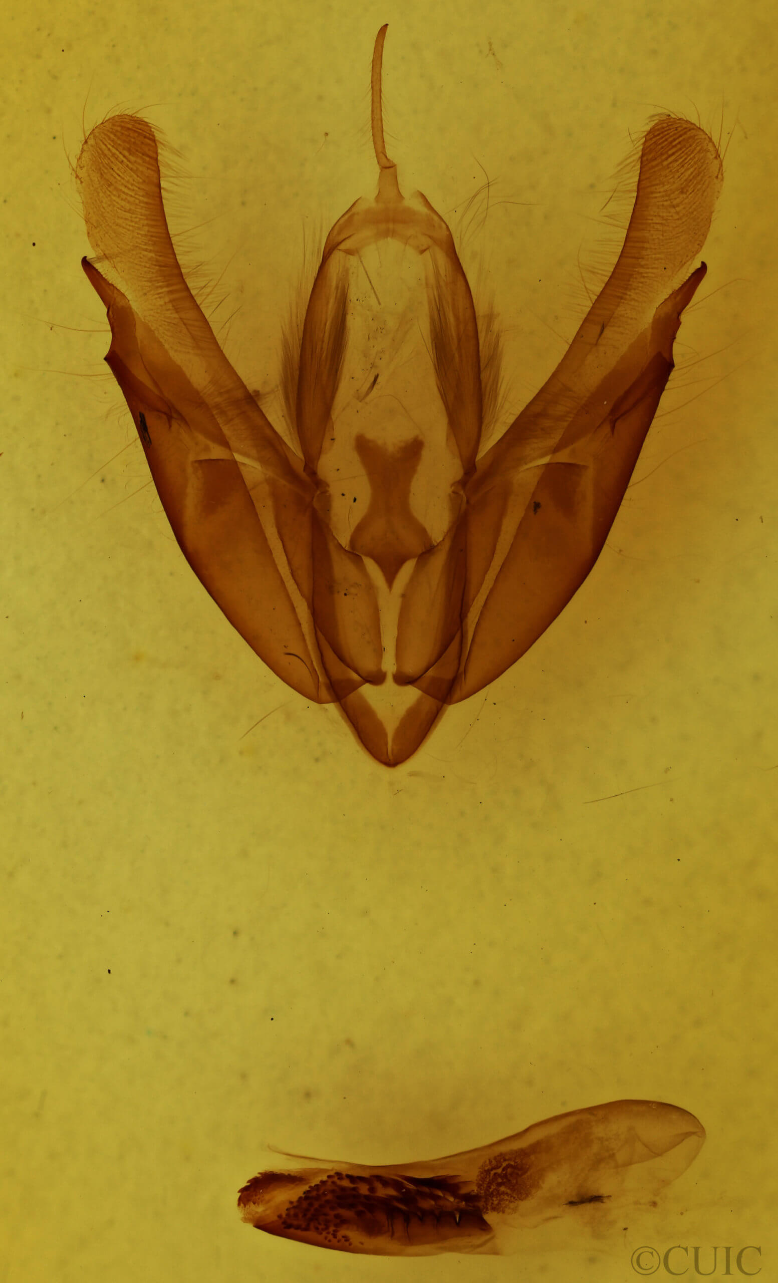 genitalia view of adult Acronicta hasta