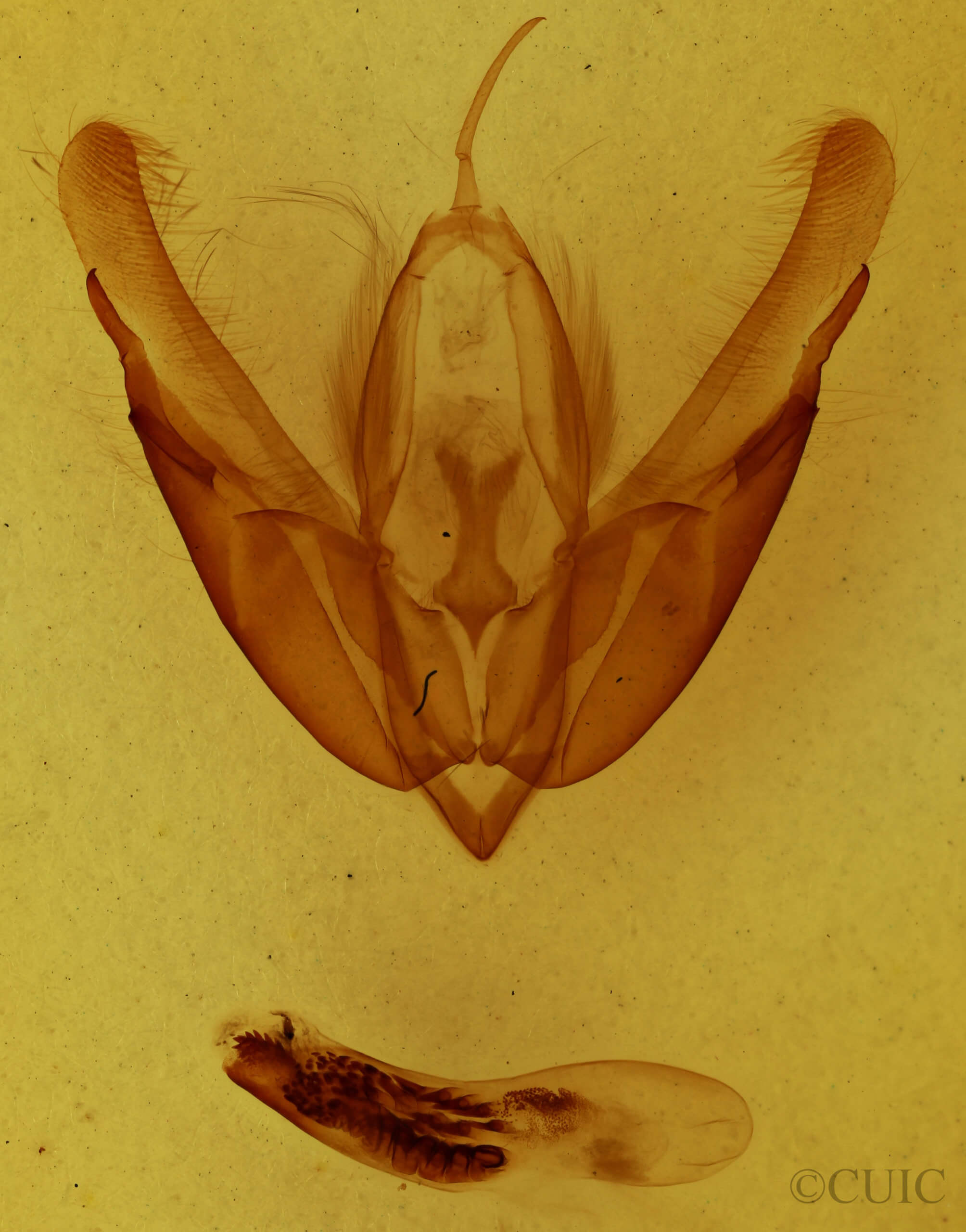 genitalia view of adult Acronicta hasta
