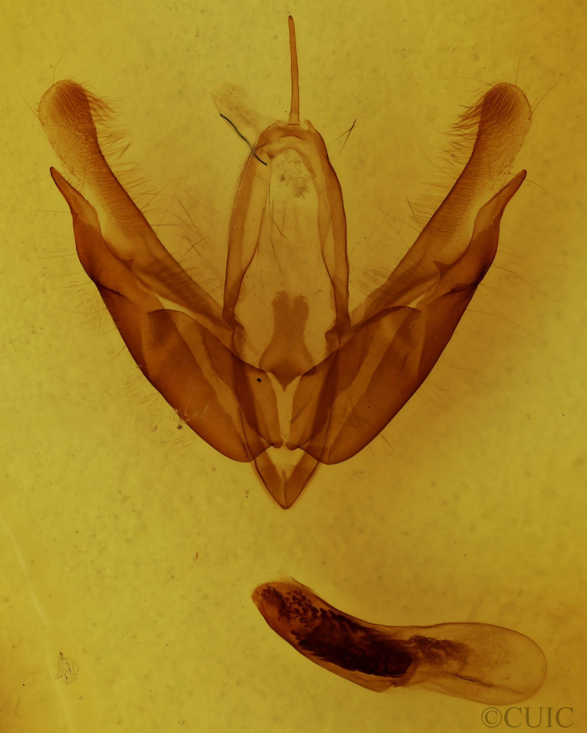 genitalia view of adult Acronicta laetifica