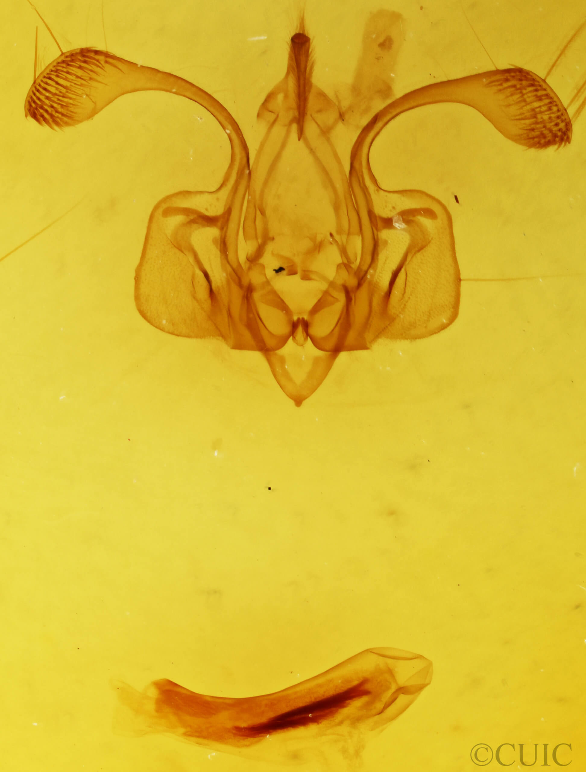genitalia view of adult Mythimna moorei