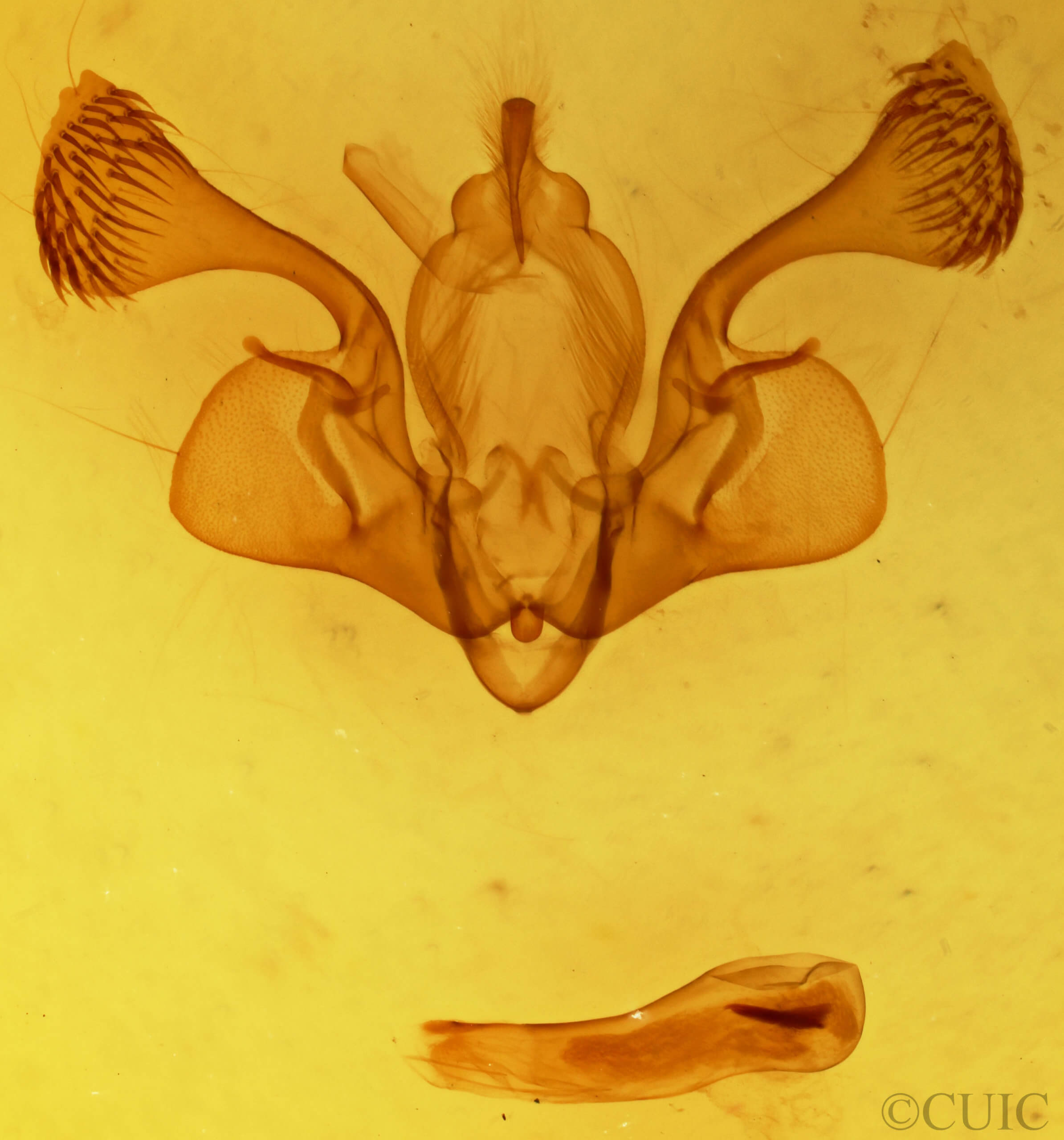 genitalia view of adult Mythimna brunneicoccinea