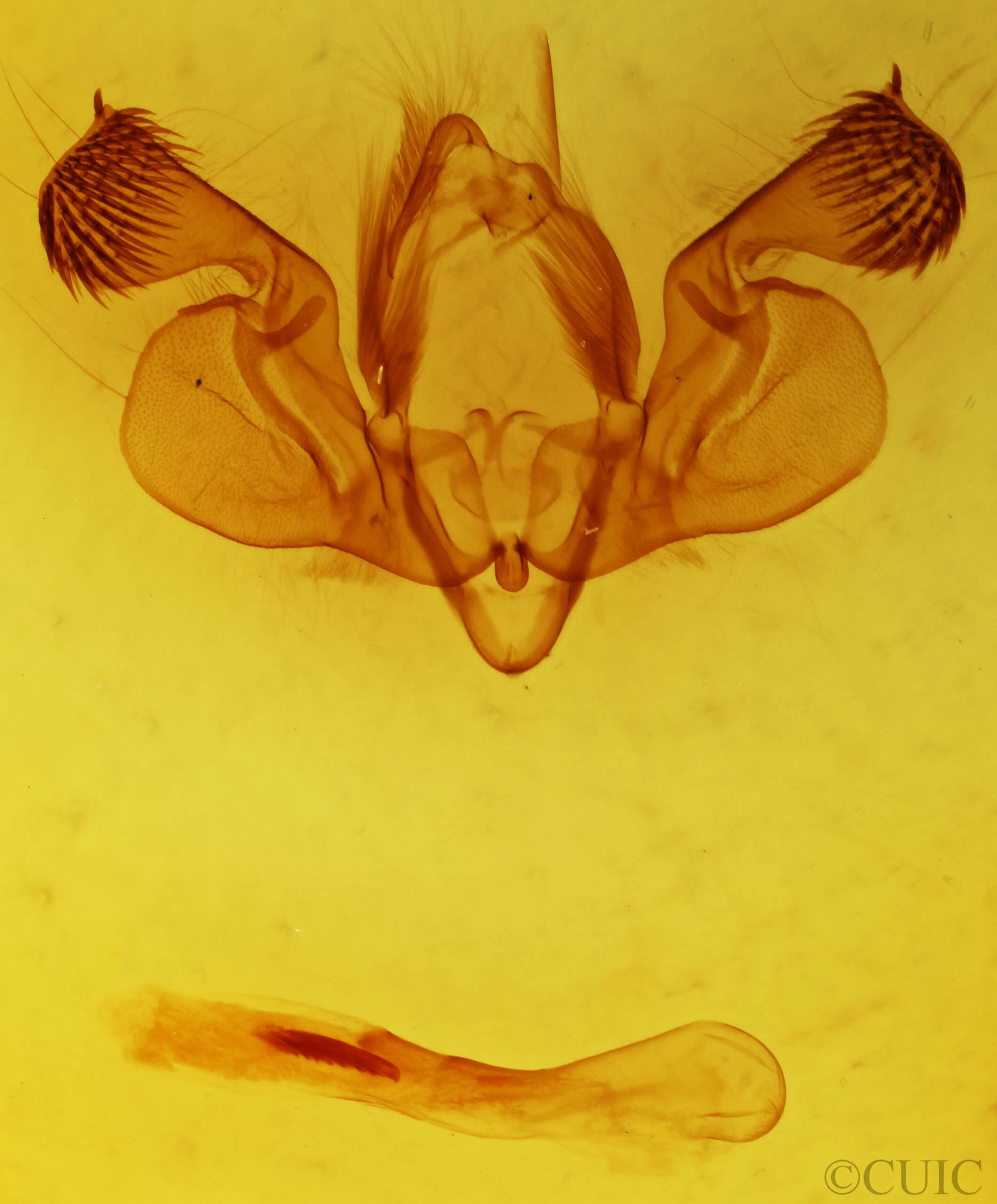 genitalia view of adult Mythimna lipara