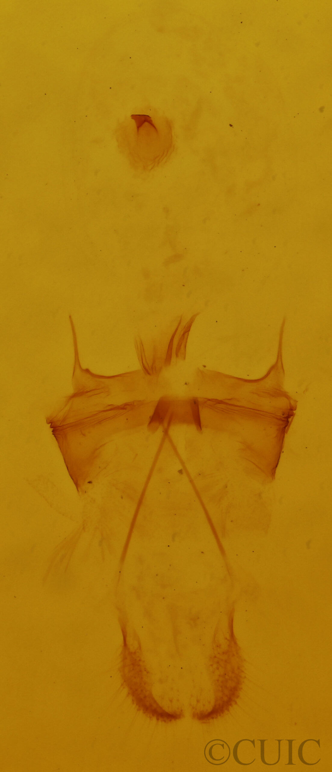 genitalia view of adult Plagodis pulveraria japonica