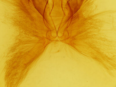 genitalia view of adult Anomis