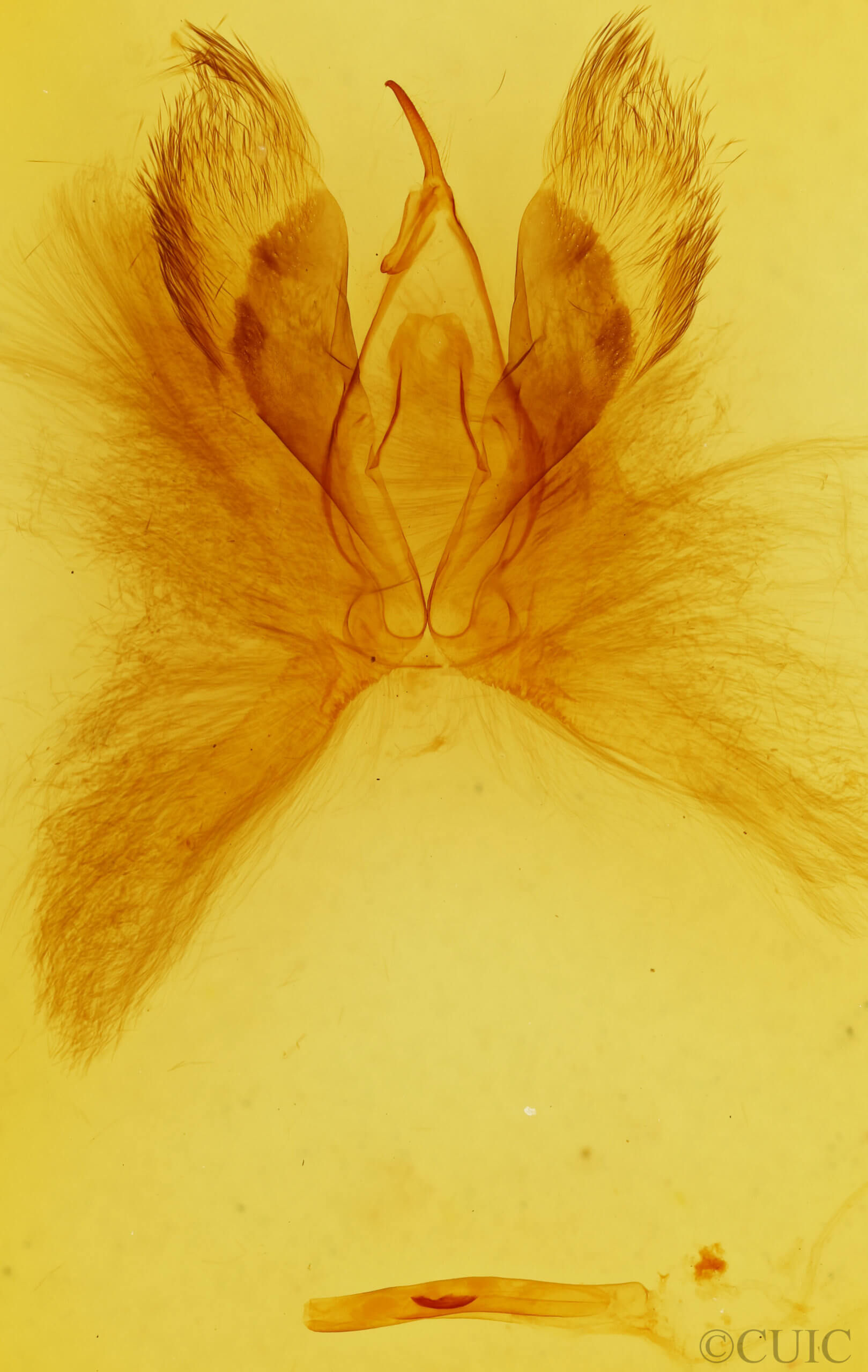 genitalia view of adult Anomis