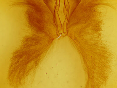 genitalia view of adult Anomis