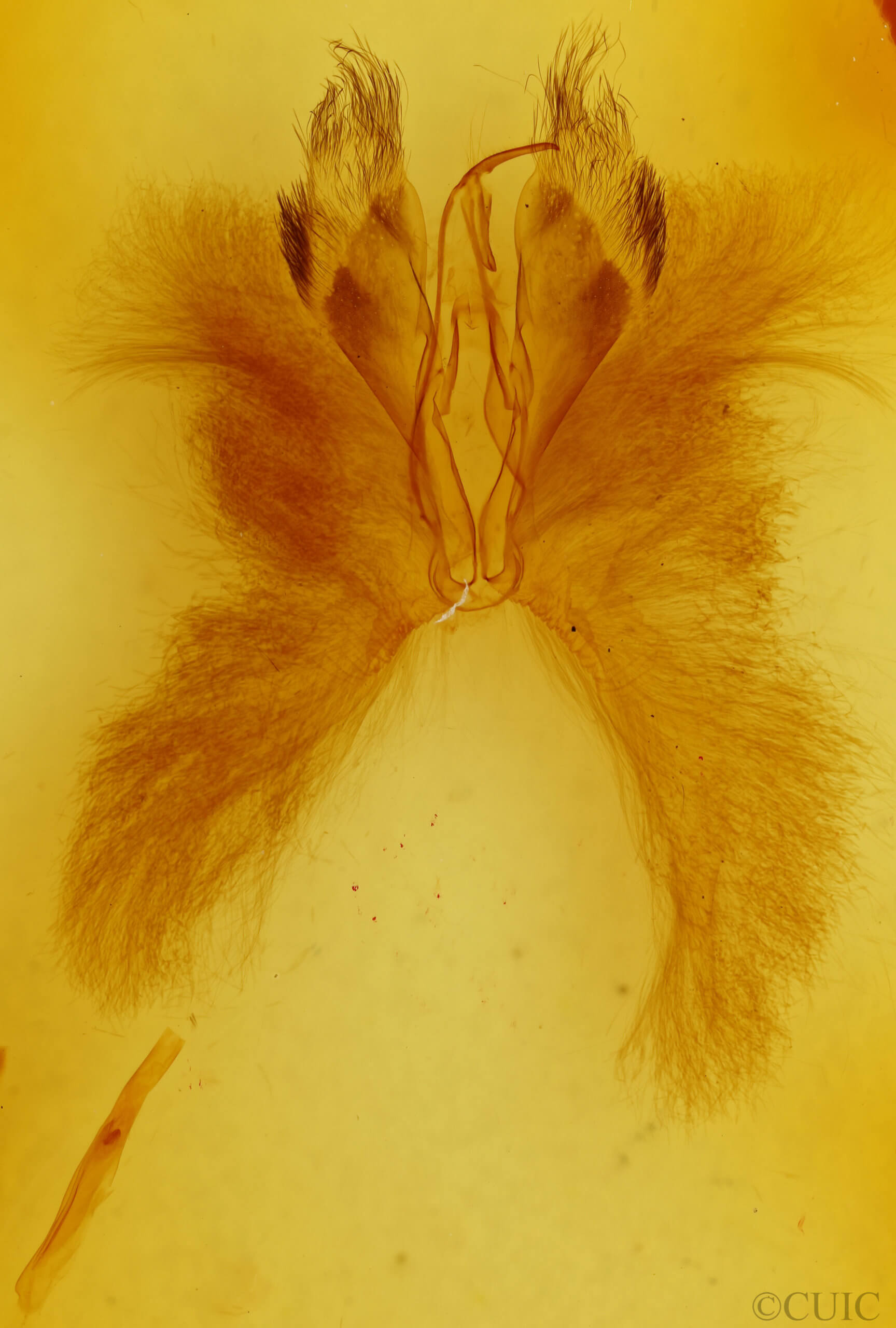 genitalia view of adult Anomis