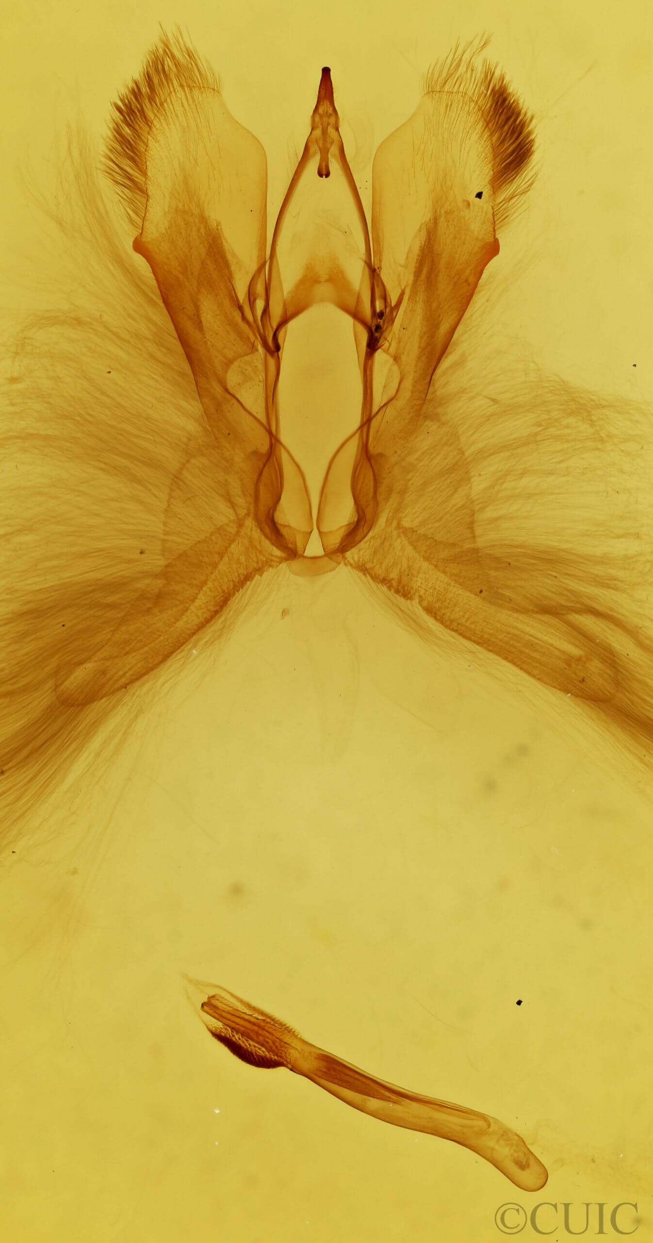genitalia view of adult Anomis