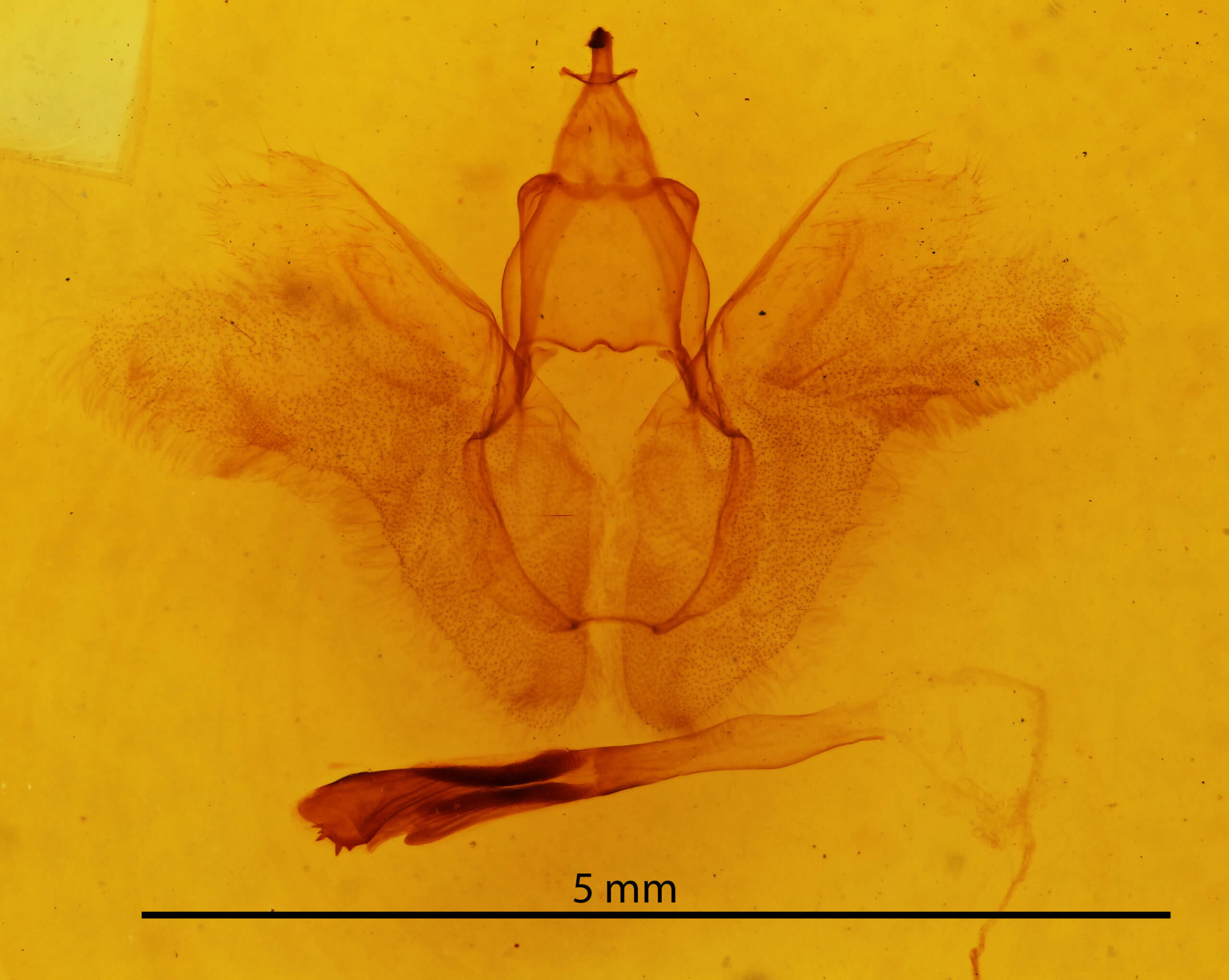 genitalia view of adult Rusicada privata