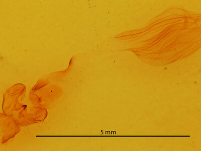 genitalia view of adult Rusicada privata