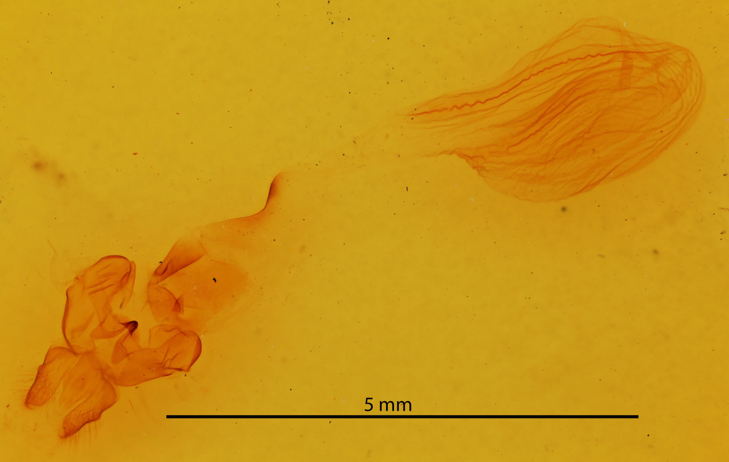 genitalia view of adult Rusicada privata