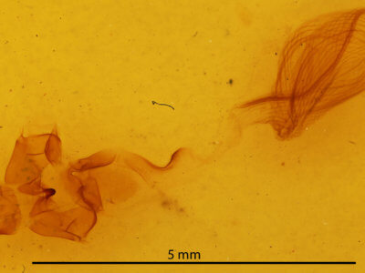 genitalia view of adult Rusicada privata