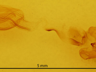 genitalia view of adult Rusicada privata