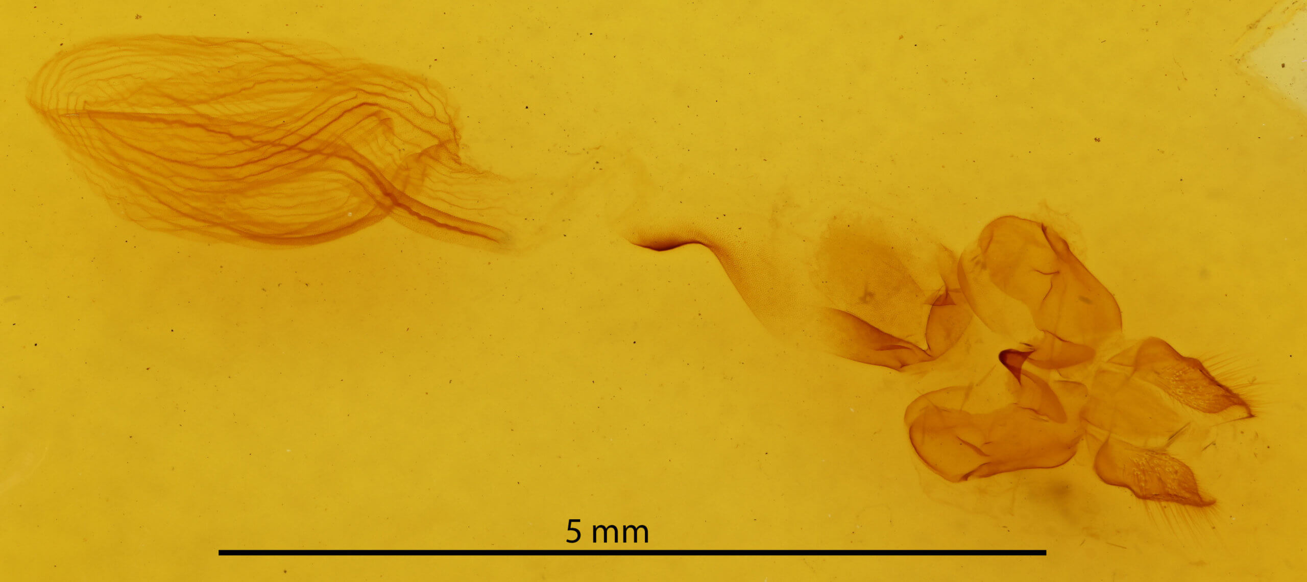 genitalia view of adult Rusicada privata