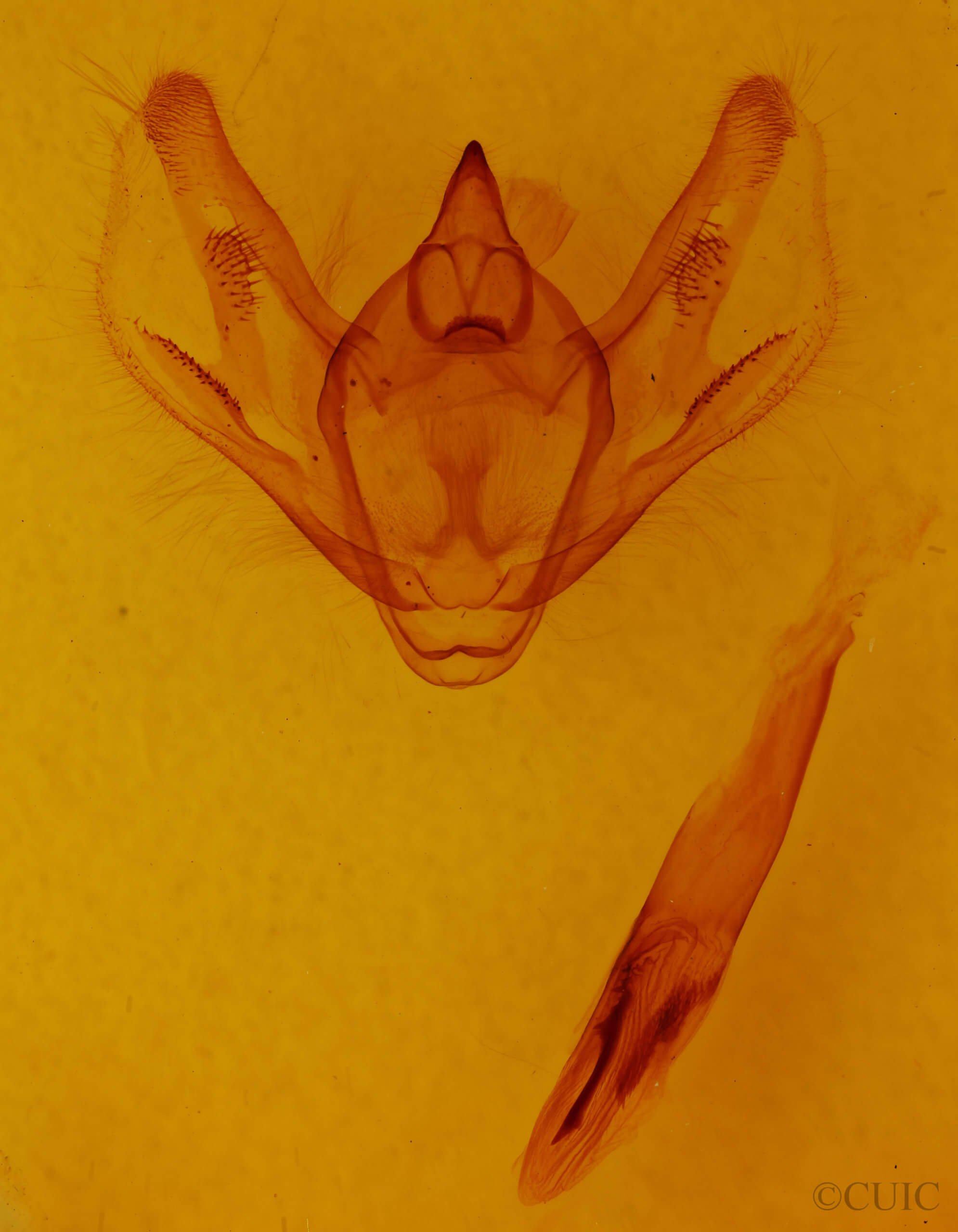 genitalia view of adult Anticypella diffusaria