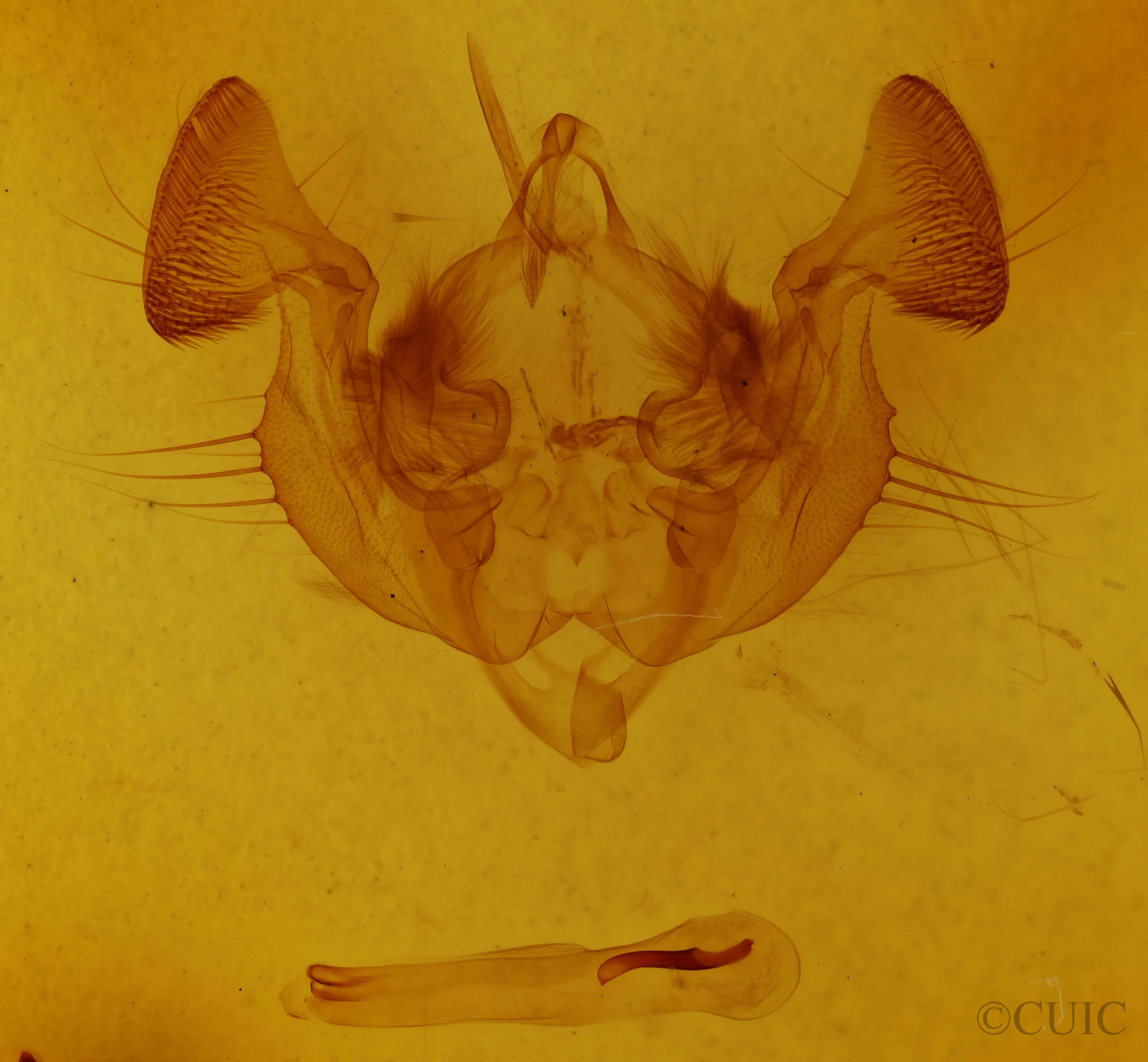 genitalia view of adult Apamea mixta
