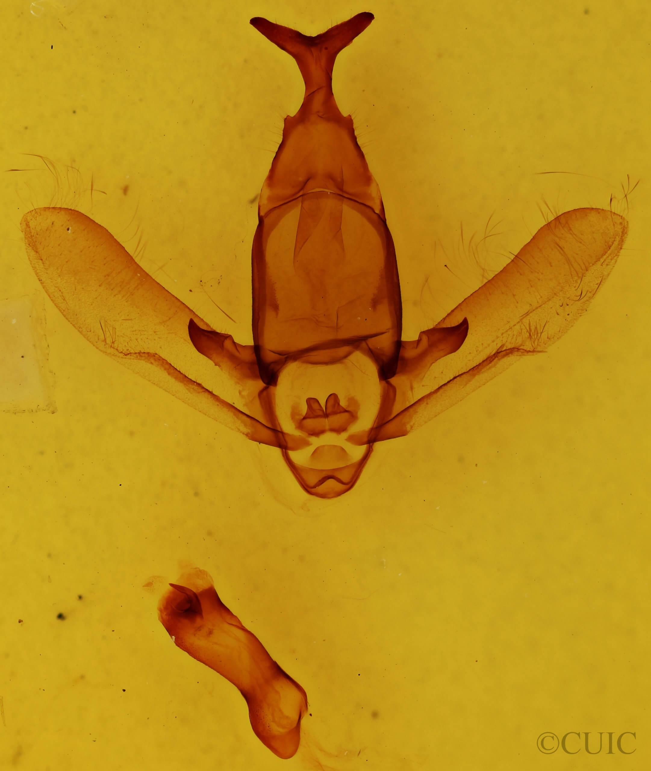 genitalia view of adult Apatelodes