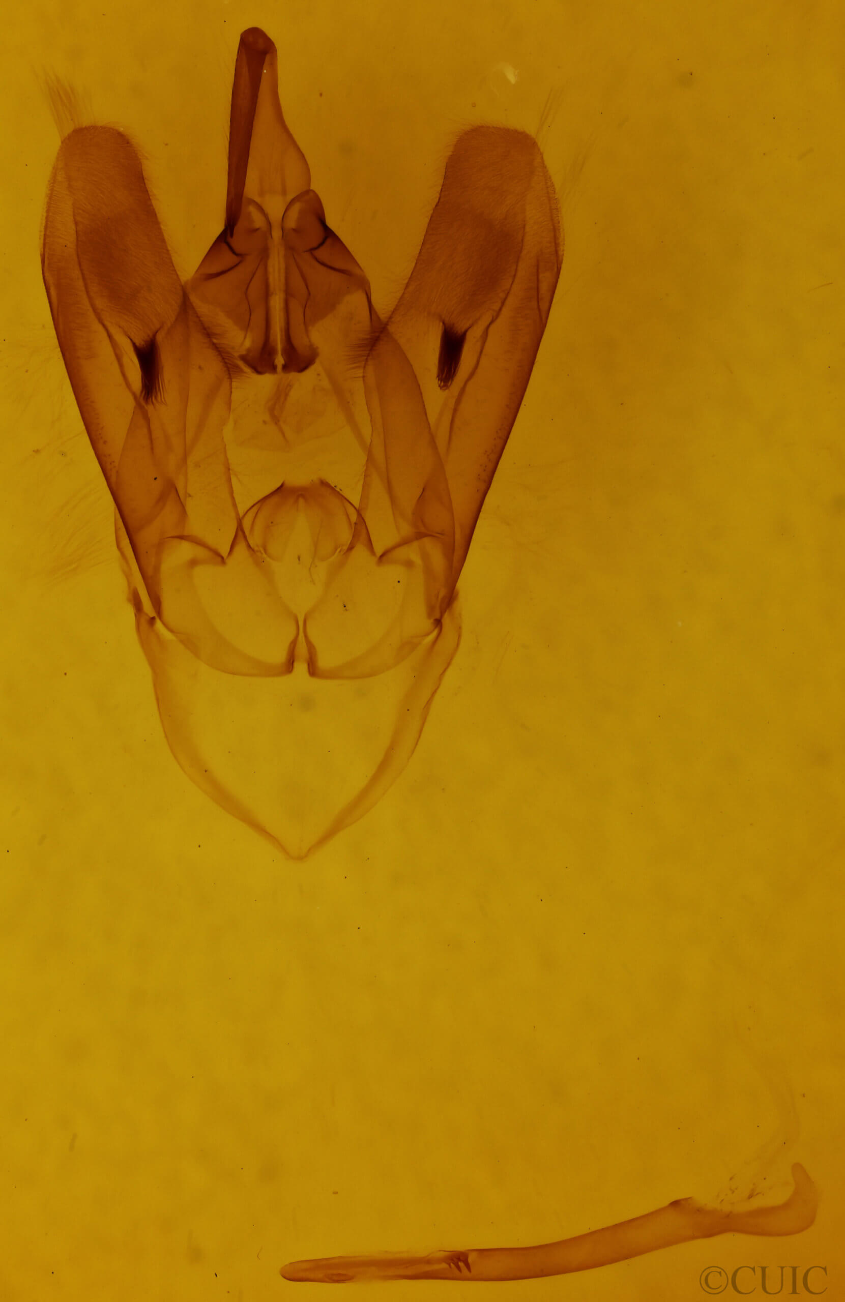 genitalia view of adult Asta quadrilinea