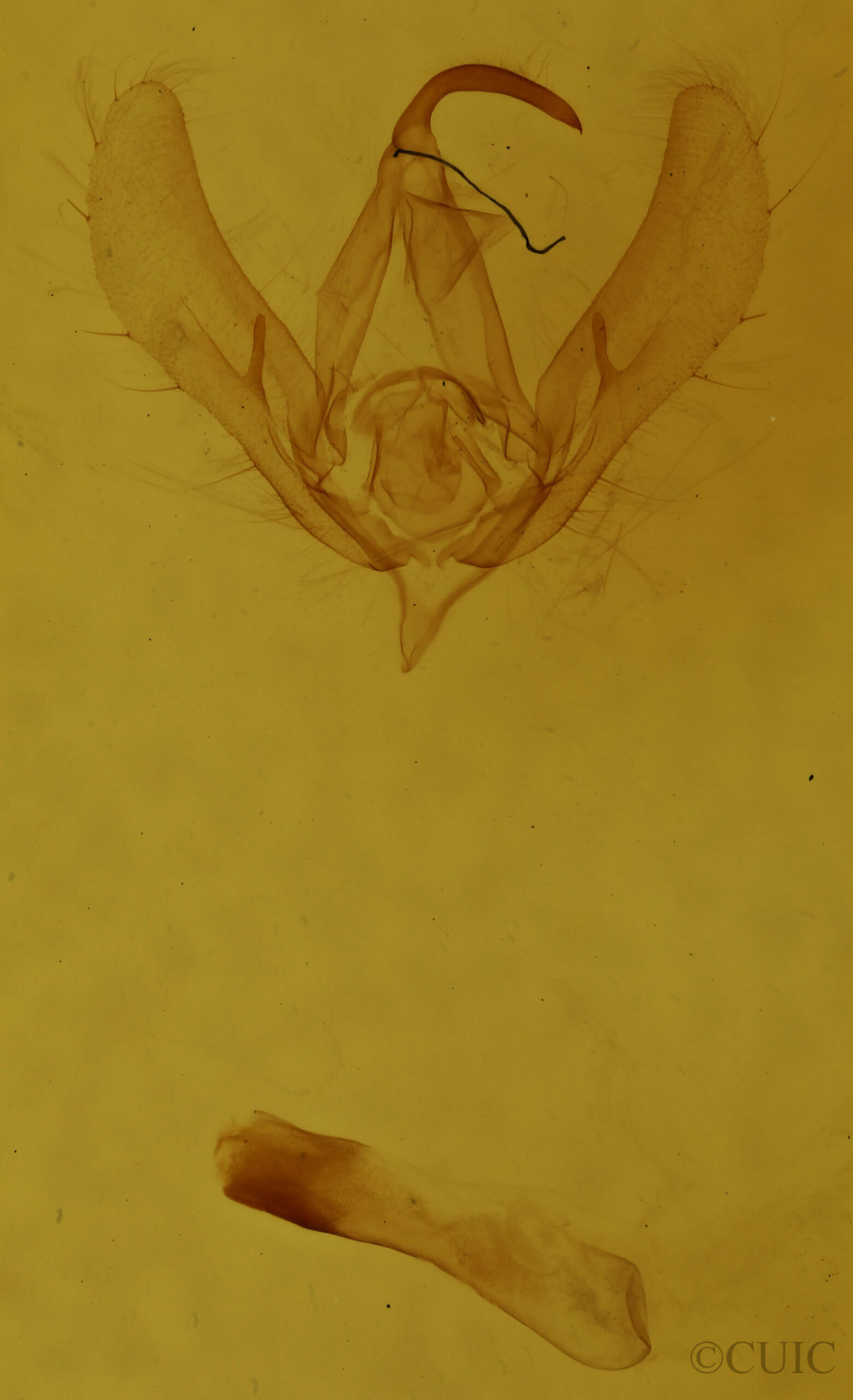 genitalia view of adult Megalographa biloba