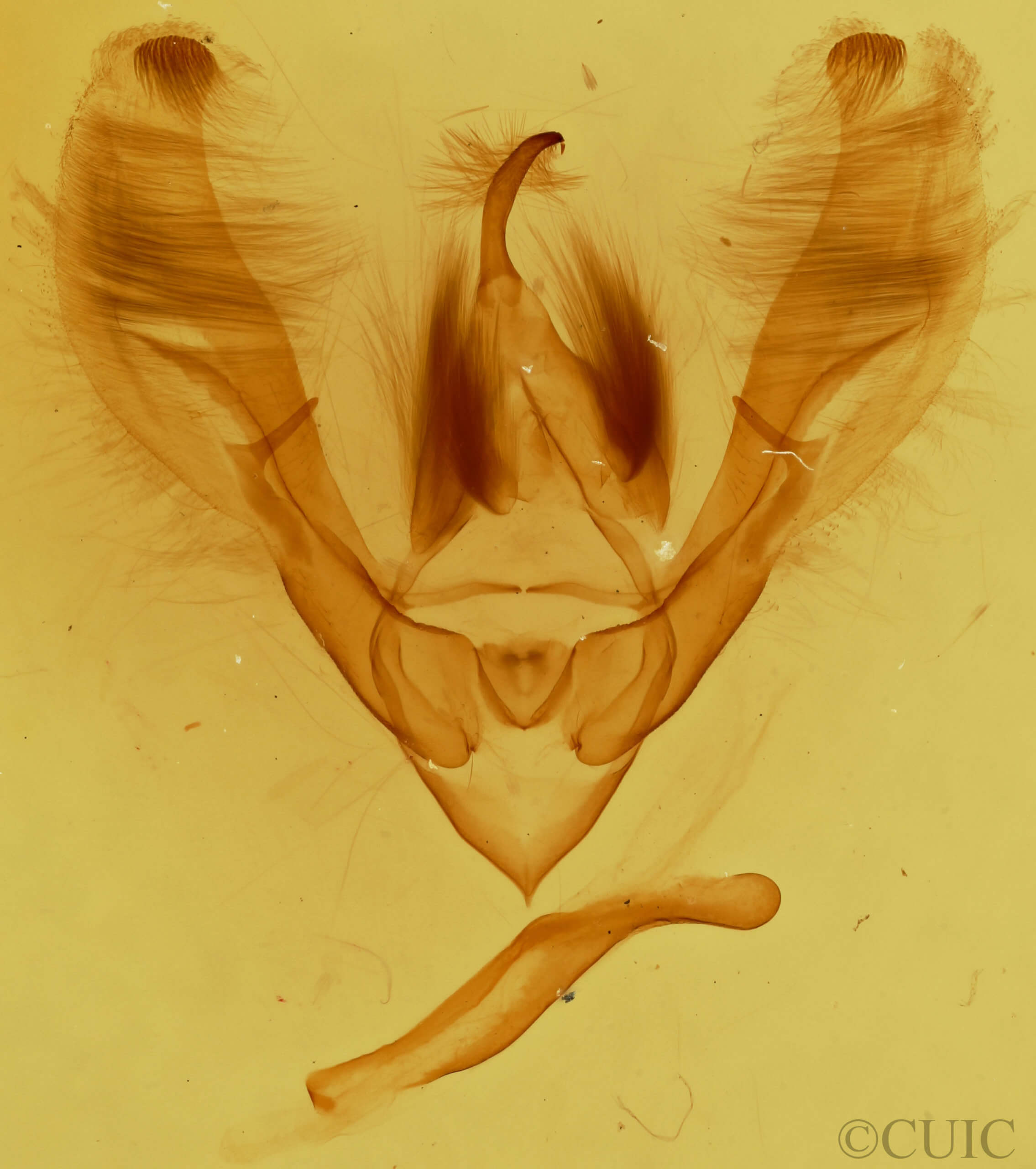 genitalia view of adult Barasa acronyctoides