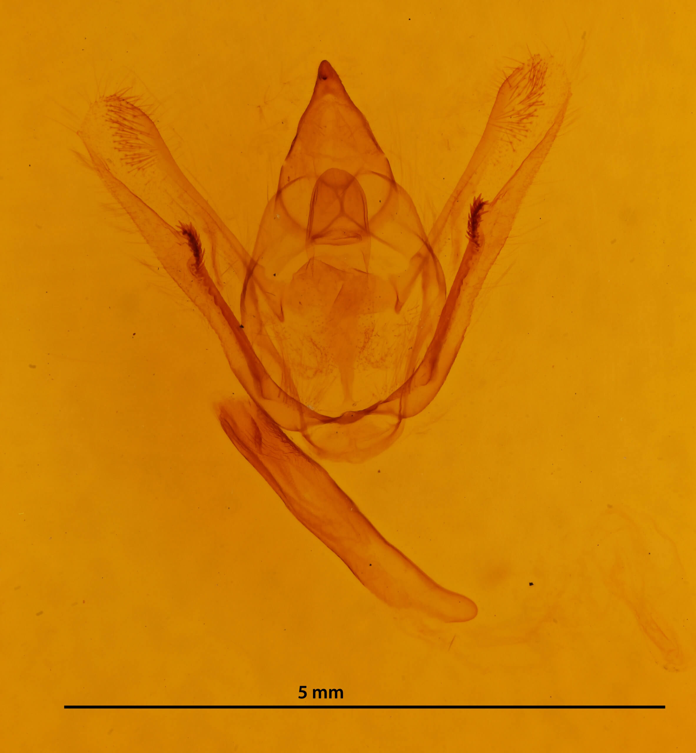 genitalia view of adult Amraica superans