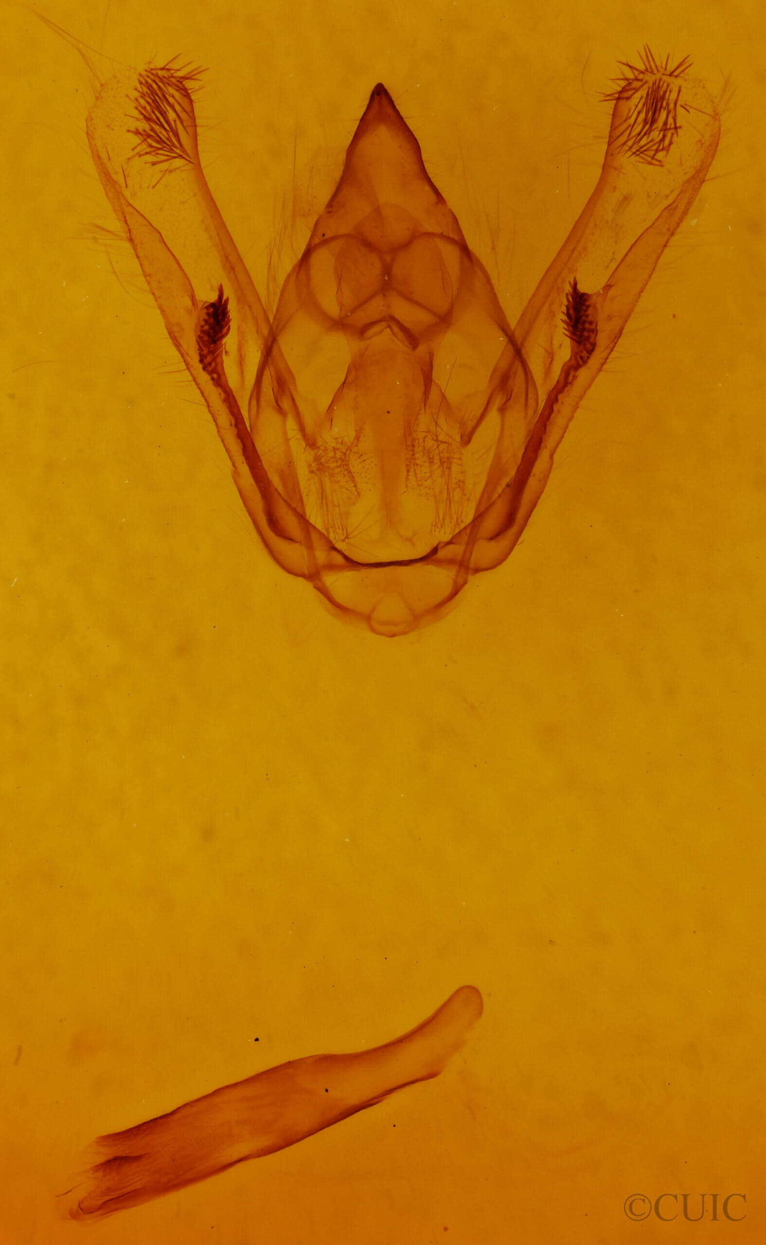 genitalia view of adult Amraica superans