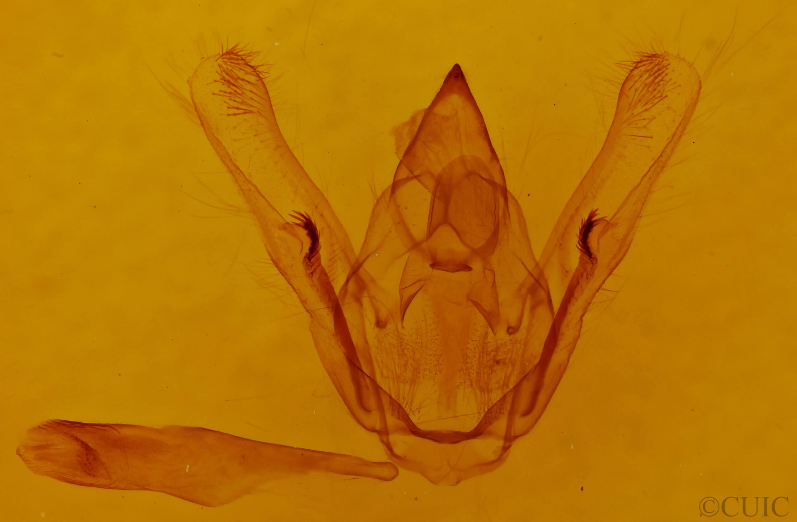 genitalia view of adult Amraica superans
