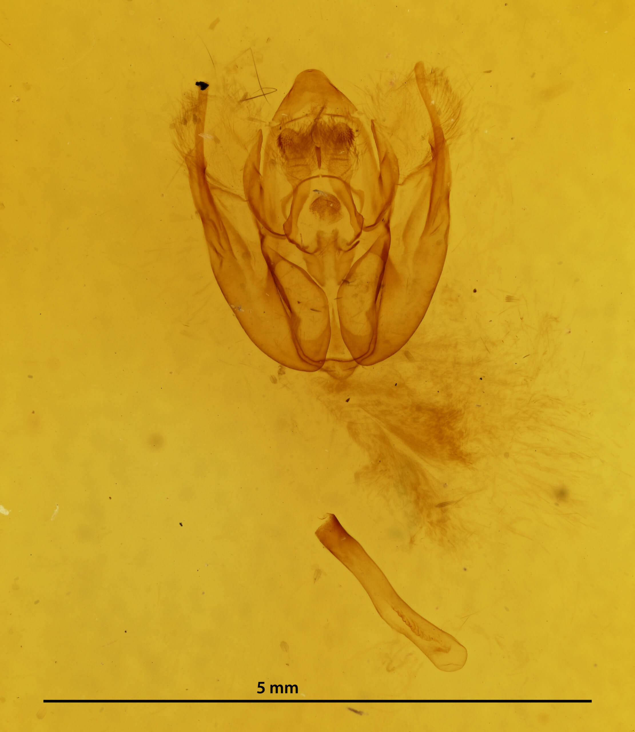 genitalia view of adult Rheumaptera undulata