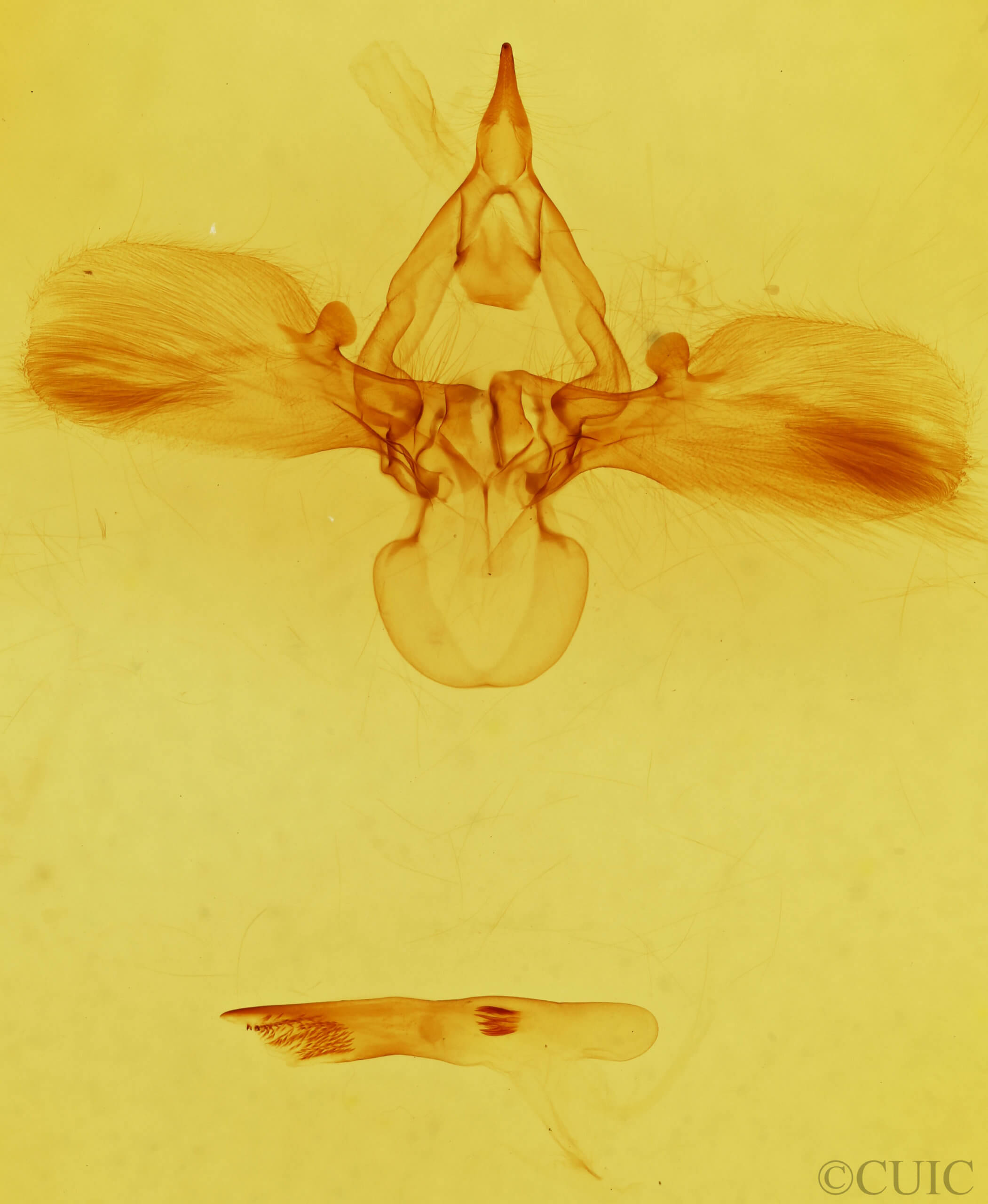 genitalia view of adult Carea