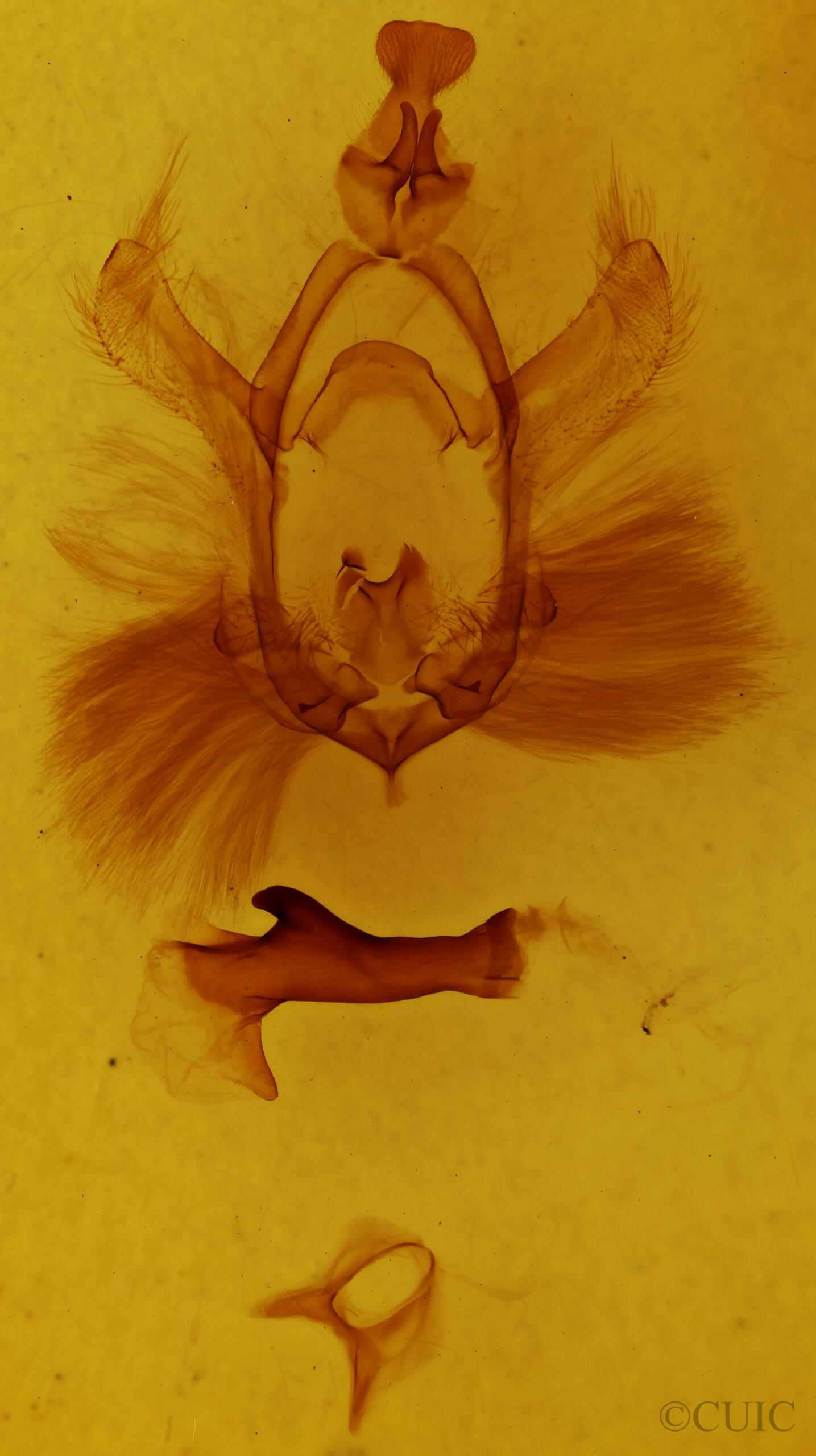 genitalia view of adult Chadisra
